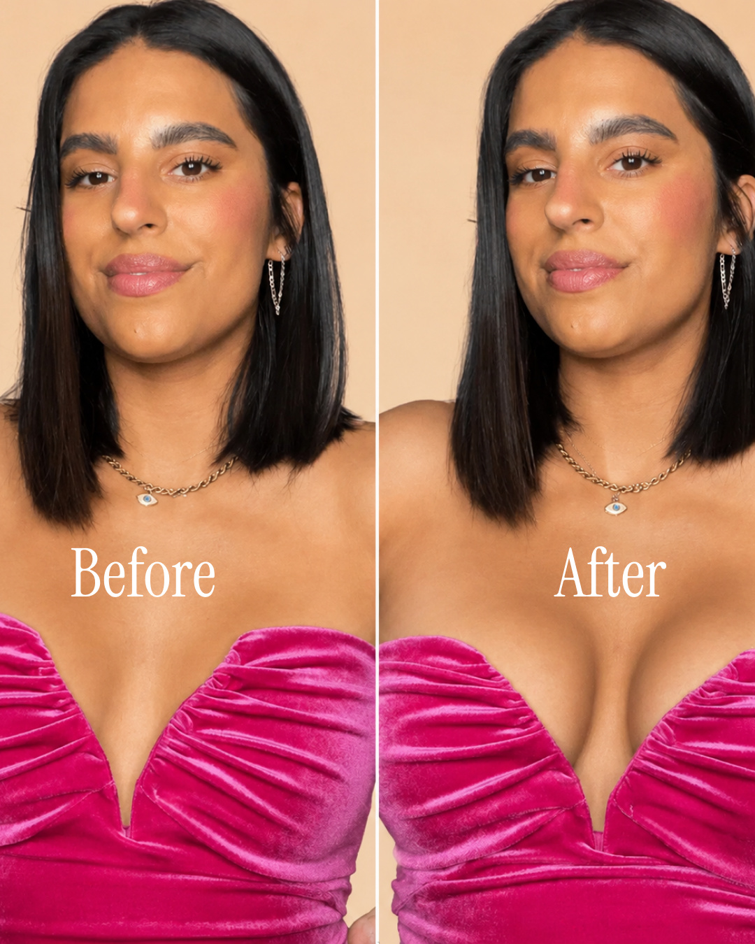 Nevera™ Invisible Lift Inserts